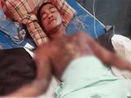 Bantah Curi Handphone, Dibakar Hidup-hidup