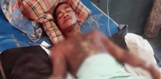 Bantah Curi Handphone, Dibakar Hidup-hidup