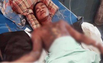 Bantah Curi Handphone, Dibakar Hidup-hidup