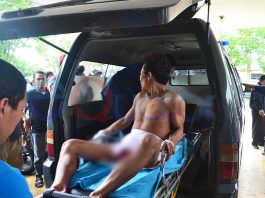 Parno dan Depresi Potong “Anu” Sendiri