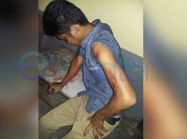 Dihadang Dua Pengendara RX King, Lengan dan Perut Dibeset Pisau