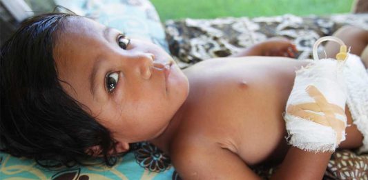 Presiden: Proses Evakuasi 99 Persen