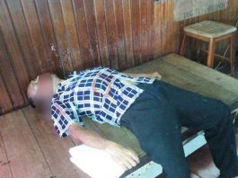 Diduga Sakit, Pria Paroh Baya Meninggal di Loby Hotel