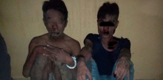 Gadis Usia 16 Tahun Bikin Dua Penjambret Biru Lebam