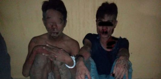 Gadis Usia 16 Tahun Bikin Dua Penjambret Biru Lebam