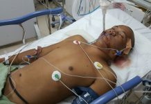 Manto Pulang ke Sambas dengan Otak Mati