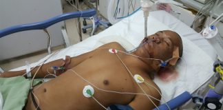 Manto Pulang ke Sambas dengan Otak Mati