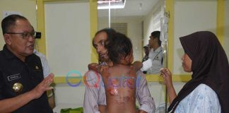 Bupati Tanggung Biaya Pengobatan Sampai Sembuh