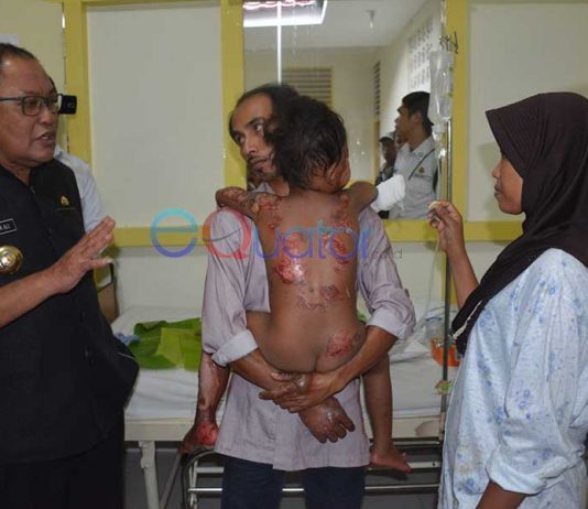 Bupati Tanggung Biaya Pengobatan Sampai Sembuh