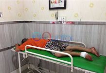 Terjun Bebas Dari Lantai 2, Kaki Patah, Angkat Jempol