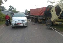 Kedua Sopir Selamat Paha Penumpang Patah