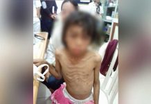 Sadis, Siksa Anak Tiri Hingga Kurus Kering