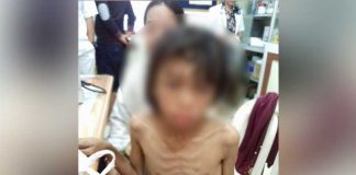 Sadis, Siksa Anak Tiri Hingga Kurus Kering