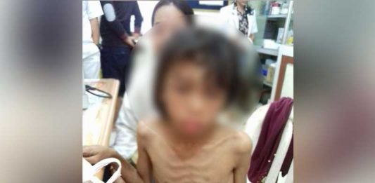 Sadis, Siksa Anak Tiri Hingga Kurus Kering