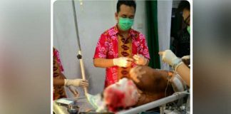 Dibacok, Gara-gara Utang Rp385 Ribu