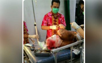 Dibacok, Gara-gara Utang Rp385 Ribu