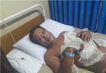 Dibakar, Pemilik Rumah Luka Bakar