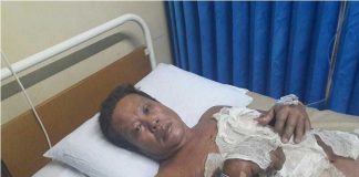 Dibakar, Pemilik Rumah Luka Bakar