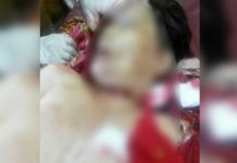 Penyakit Tak Sembuh Lie Moi Pilih Eutanasia