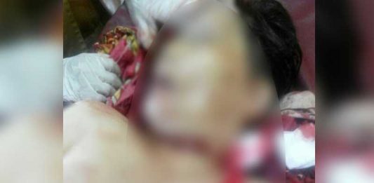 Penyakit Tak Sembuh Lie Moi Pilih Eutanasia