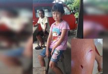 Delapan Anak Digigit Anjing Rabies