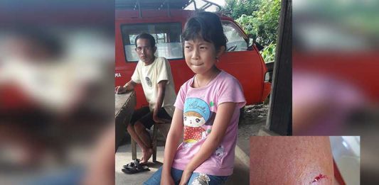 Delapan Anak Digigit Anjing Rabies