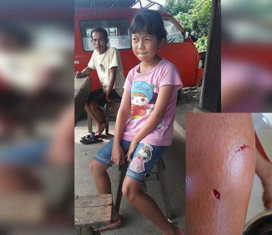 Delapan Anak Digigit Anjing Rabies