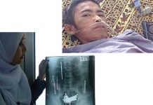 Barang-Barang Tak Lazim di Perut Mereka