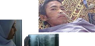 Barang-Barang Tak Lazim di Perut Mereka