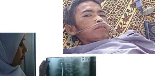 Barang-Barang Tak Lazim di Perut Mereka