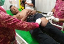 Nekat Jambret Siang Bolong di Dekat Polsek, Paha Win Dibolongi