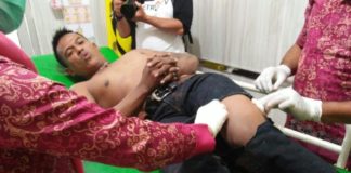 Nekat Jambret Siang Bolong di Dekat Polsek, Paha Win Dibolongi