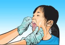 Mempawah Aman dari Difteri