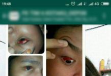 Kabar Meresahkan soal Virus Radiasi Ponsel