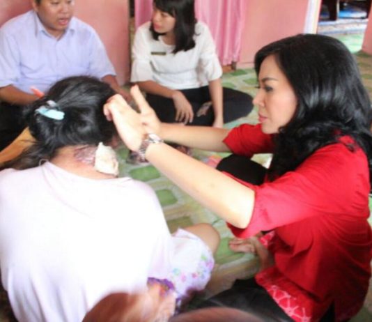 Karolin Upayakan Pengobatan Pasien Kanker Mulut Calon Gubernur Kalimantan Barat, dr. Karolin Margret Natasa menjenguk Regina, 38 tahun yang diagnosis terkena kanker mulut.
