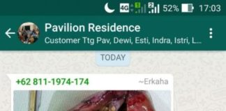 Soft Drink dan Batu Ginjal