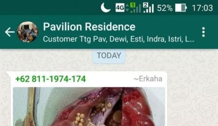 Soft Drink dan Batu Ginjal