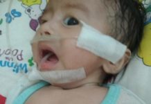 Dada Cekung saat Bernafas, akan Dirujuk ke Malaysia INFEKSI PARU-PARU. Ilyas sedang menjalani perawatan di kamar anak RSUD dr. Soedarso Pontianak. Suci Nurdini Setiowati-RK