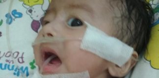 Dada Cekung saat Bernafas, akan Dirujuk ke Malaysia INFEKSI PARU-PARU. Ilyas sedang menjalani perawatan di kamar anak RSUD dr. Soedarso Pontianak. Suci Nurdini Setiowati-RK