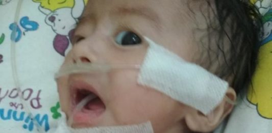 Dada Cekung saat Bernafas, akan Dirujuk ke Malaysia INFEKSI PARU-PARU. Ilyas sedang menjalani perawatan di kamar anak RSUD dr. Soedarso Pontianak. Suci Nurdini Setiowati-RK