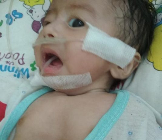 Dada Cekung saat Bernafas, akan Dirujuk ke Malaysia INFEKSI PARU-PARU. Ilyas sedang menjalani perawatan di kamar anak RSUD dr. Soedarso Pontianak. Suci Nurdini Setiowati-RK