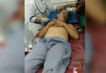 Akhiang Dianiaya Sekelompok Orang KORBAN PENGANIAYAAN. Akhiang mendapatkan perawatan di RS Kharitas Bakti, Selasa (2/5). Warga for RK