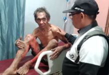 Pembakaran Lahan Makan Korban Jiwa Adong, salah satu korban kebakaran lahan saat dibawa ke rumah sakit bersama dua korban lainnya ---Warga For Rakyat Kalbar