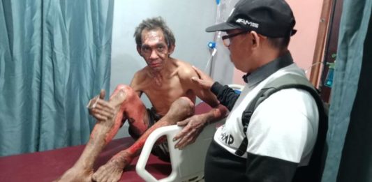 Pembakaran Lahan Makan Korban Jiwa Adong, salah satu korban kebakaran lahan saat dibawa ke rumah sakit bersama dua korban lainnya ---Warga For Rakyat Kalbar