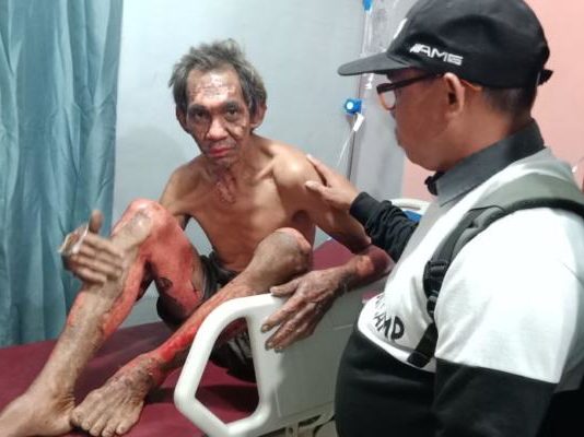 Pembakaran Lahan Makan Korban Jiwa Adong, salah satu korban kebakaran lahan saat dibawa ke rumah sakit bersama dua korban lainnya ---Warga For Rakyat Kalbar