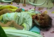 Divonis Derita Bocor Jantung, Maximus Casilaz Butuh Uluran Tangan