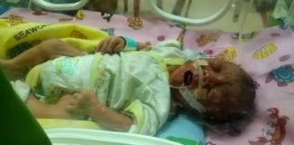 Divonis Derita Bocor Jantung, Maximus Casilaz Butuh Uluran Tangan