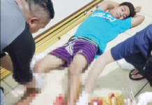 Curi Motor untuk Biaya Nikah, LT Dibuat Pincang Jatanras