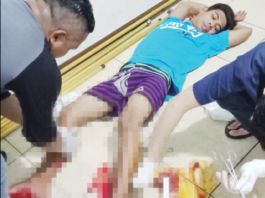 Curi Motor untuk Biaya Nikah, LT Dibuat Pincang Jatanras