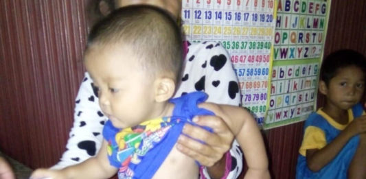 Jalani Operasi Kedua, Rafa Butuh Uluran Tangan BUTUH BANTUAN. Arnita dan anaknya Rafa Rafa Fauzan Kamil dikediamannya di Dusun Liang Desa Tekelak, Pinoh Utara, Melawi, Rabu (8/8). Dedi Irawan-RK